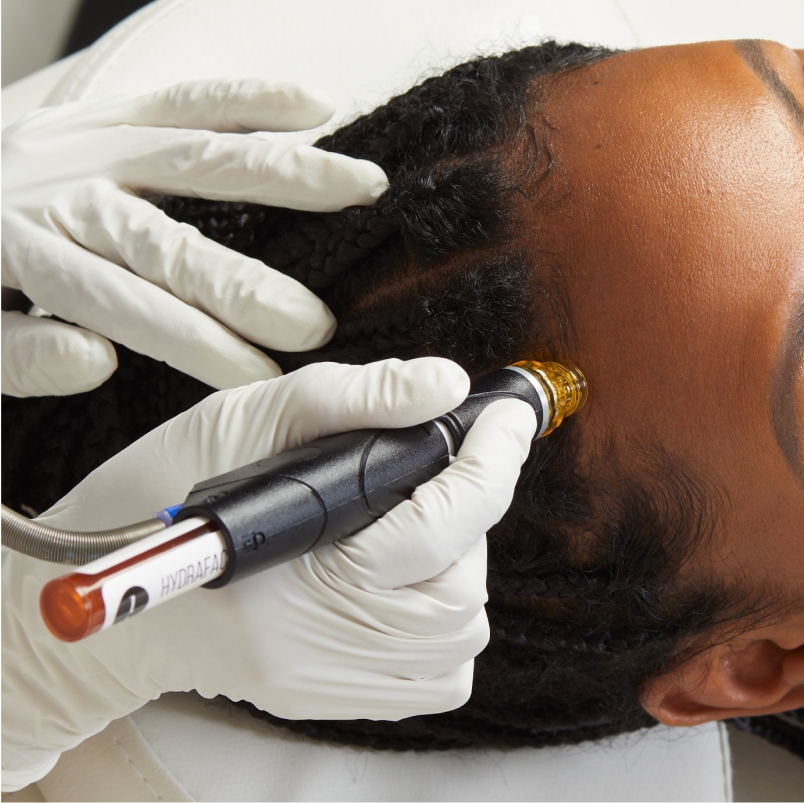 new york hydrafacial scalp treatment